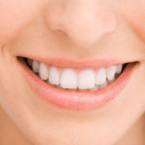 healing vinegar white teeth