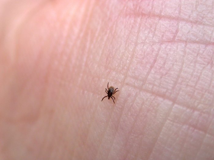 tick on a person's skin