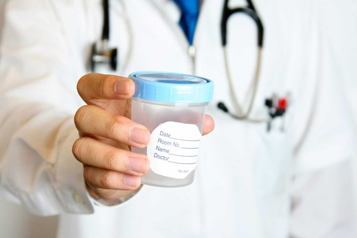 hand holding urine specimen cup