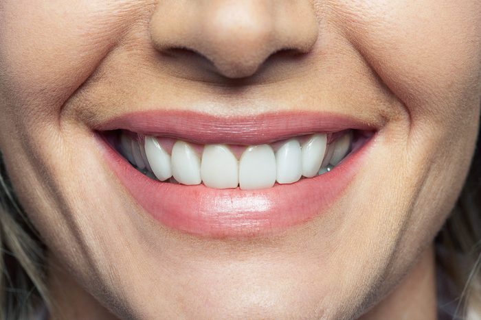 woman's smile with white teeth