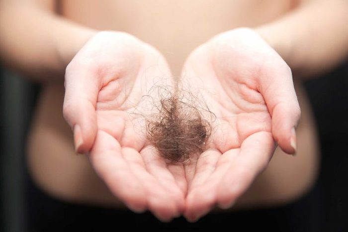 Woman holding a clump of hair in her open palms.