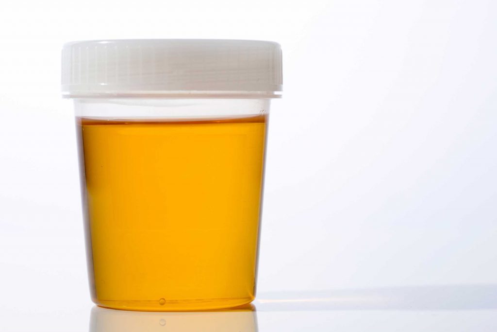  Urine  Infections Urine  Color What Urine  Says About 