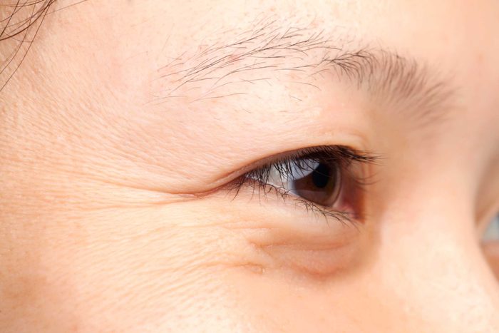 Closeup of wrinkles around an eye.