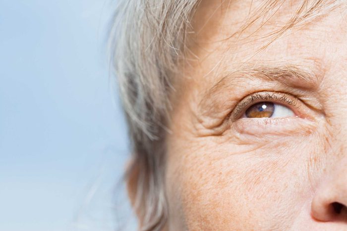 Closeup of wrinkles around the eye.