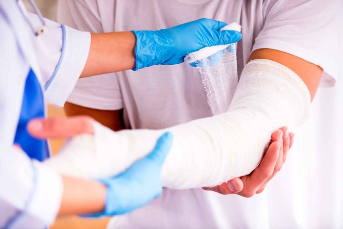 close up of a doctor wrapping a cast on a person's arm
