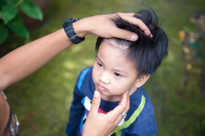 Parent checking a little boy's hair and throat.