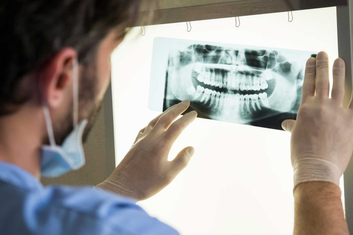 man looking at dental X-ray