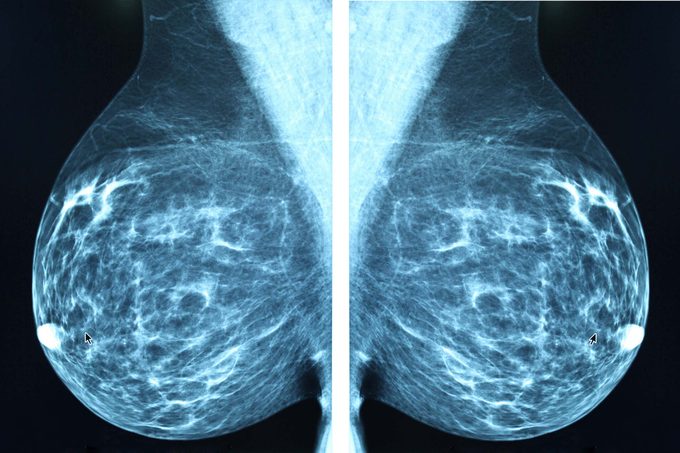 02-did-abnormal-mammogram-questions-BluePlanetEarth