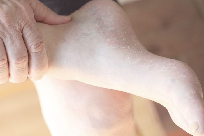 Signs of Disease Your Feet Can Reveal | The Healthy @Reader's Digest