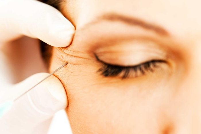 close up of a doctor inserting a needle into a woman's crows feet