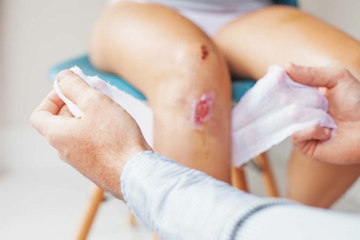 doctor's hands wrapping a gauze around a scraped knee