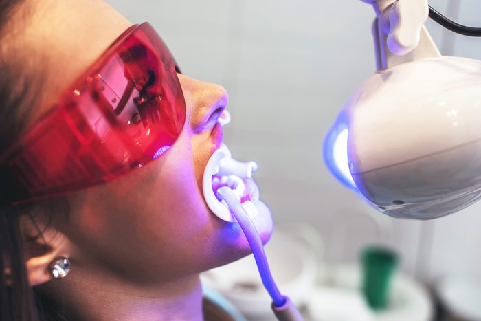 woman getting her teeth professionally whitened