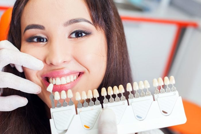 dentist holding up tooth molds next to woman's smile