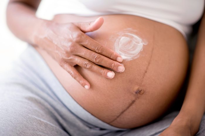 moisturizing pregnant belly stretch marks