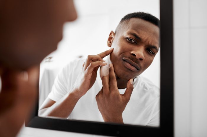 man popping pimple in mirror