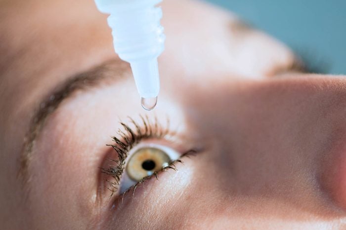 Woman applying eye drops to one of her eyes.