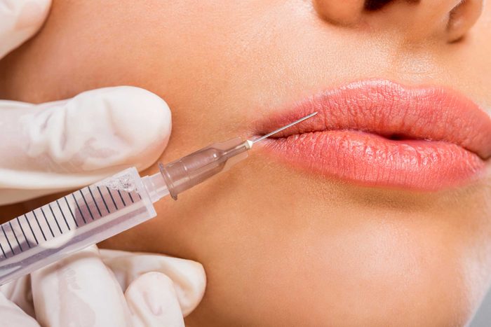 Needle injection into lip