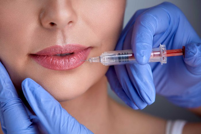 Needle injection into lips
