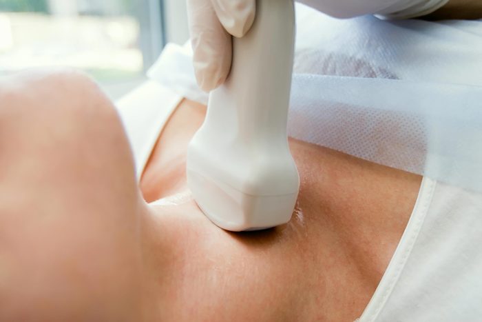 woman getting an ultrasound thyroid scan
