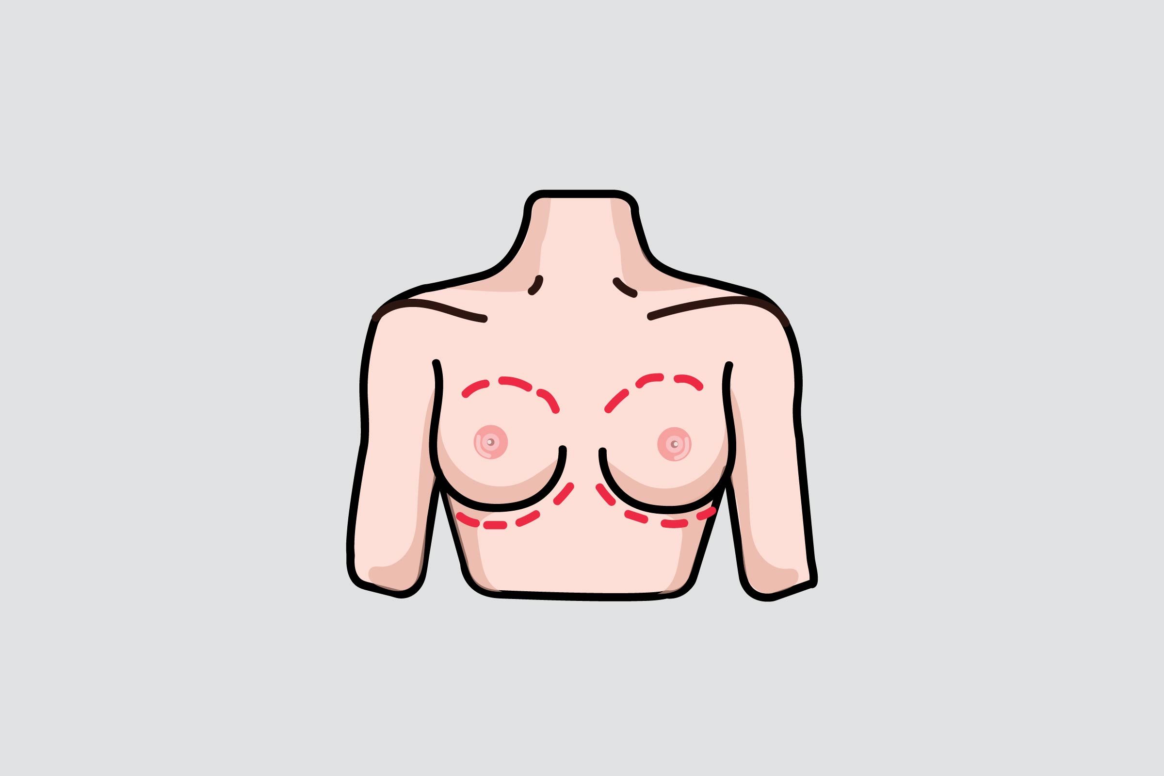 illustration of chest