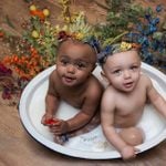 How These Twin Babies Were Born with Different Skin Colors