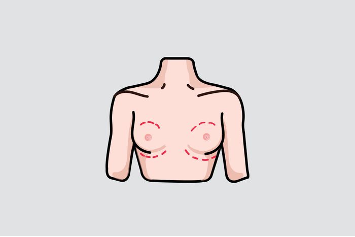 illustration of breasts