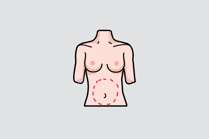 illustration of a woman's abdomen