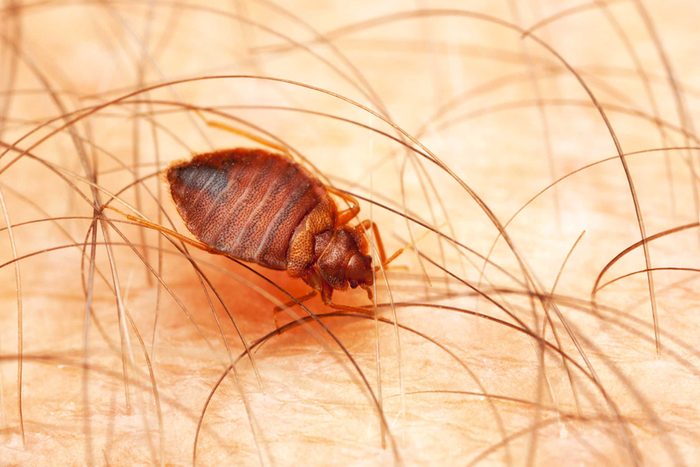 magnification of a bed bug on human skin