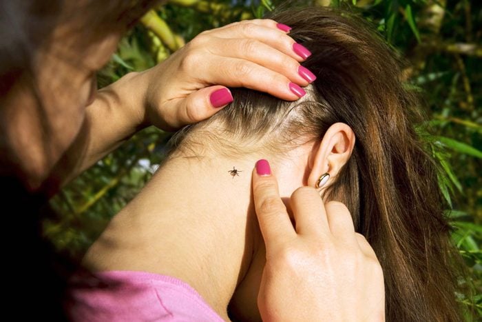 Woman with a tick on her neck