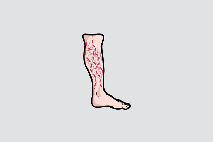 illustration of a lower leg