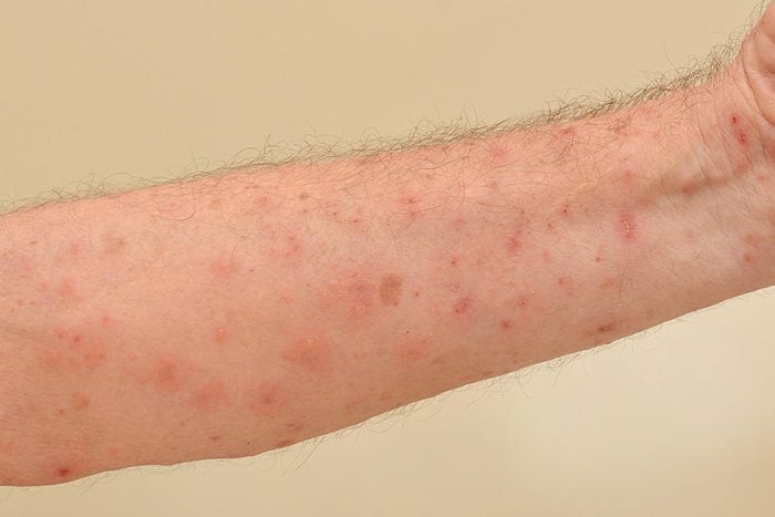 itchy red spots on skin of arm