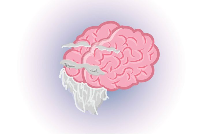 Graphic of human brain