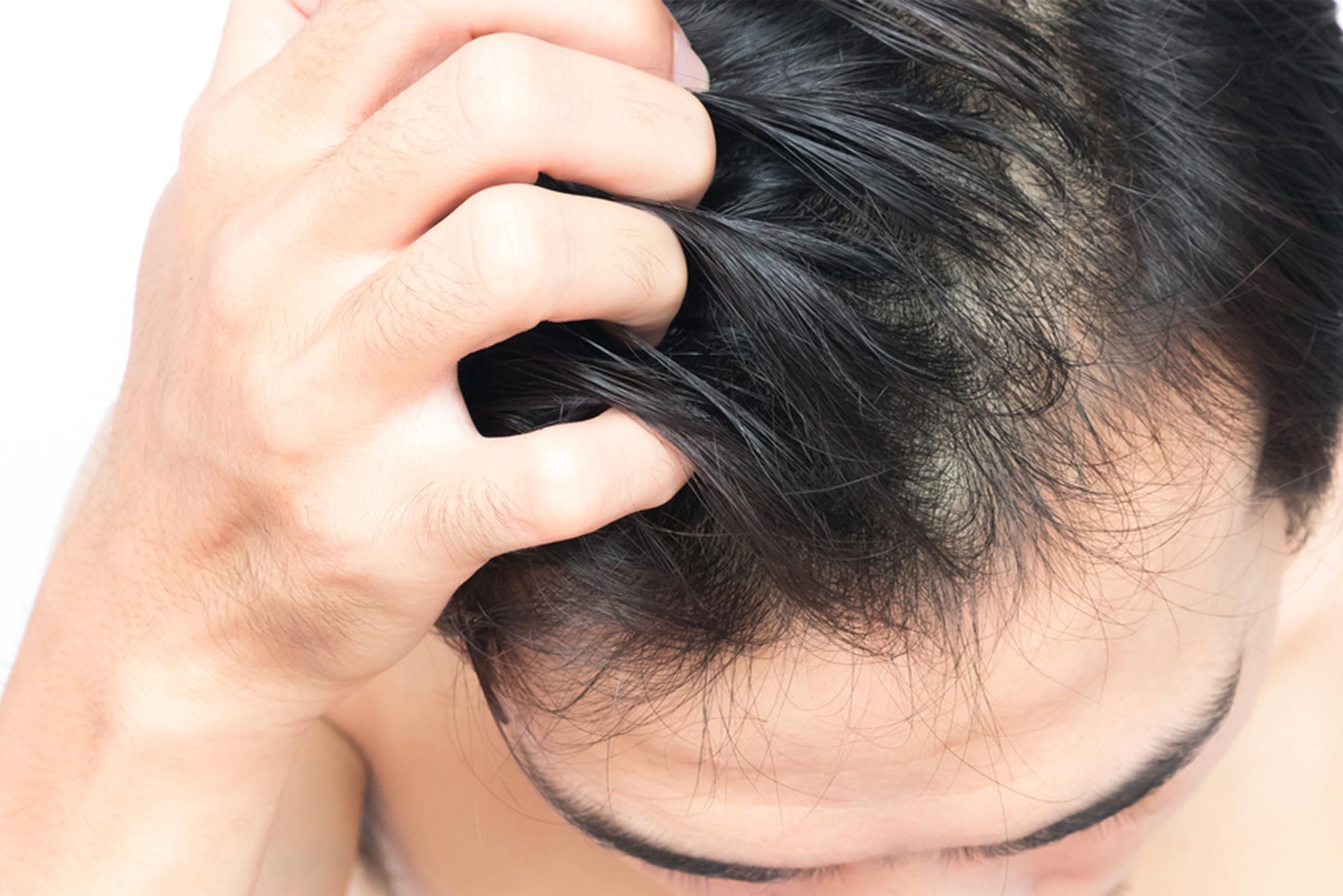 20 Reasons For Your Itchy Scalp Besides Head Lice The Healthy