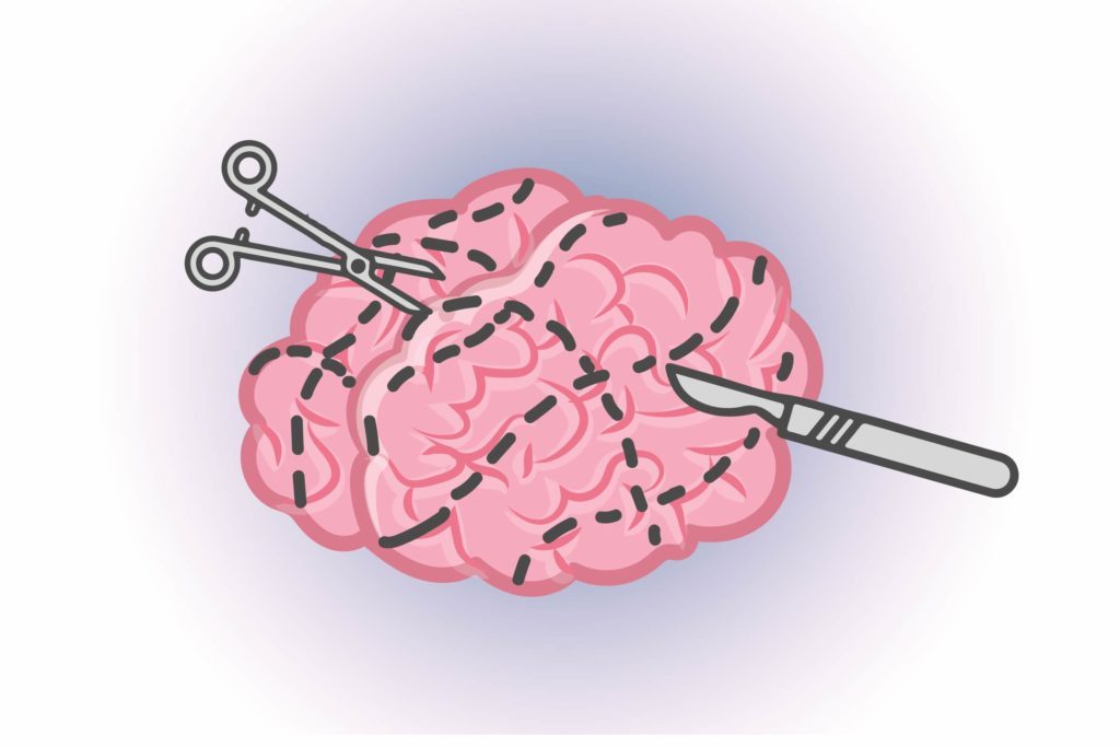 Graphic of human brain with scalpel and knife