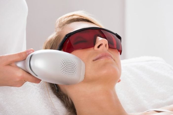 woman getting laser treatment on face