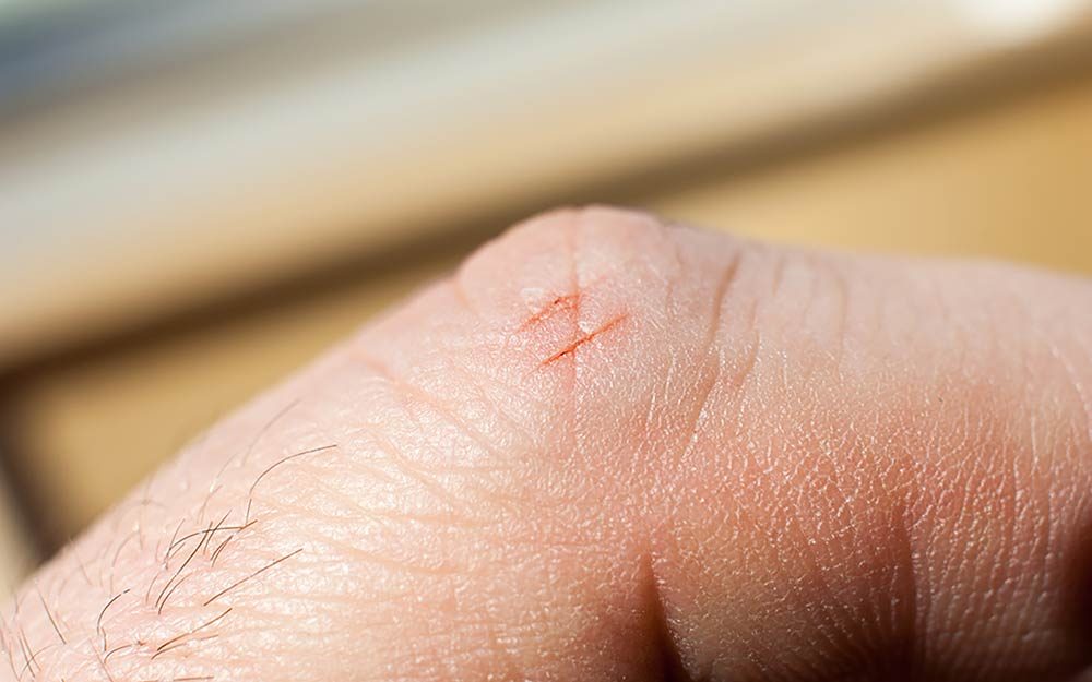 Paper cuts - here's why they hurt so much