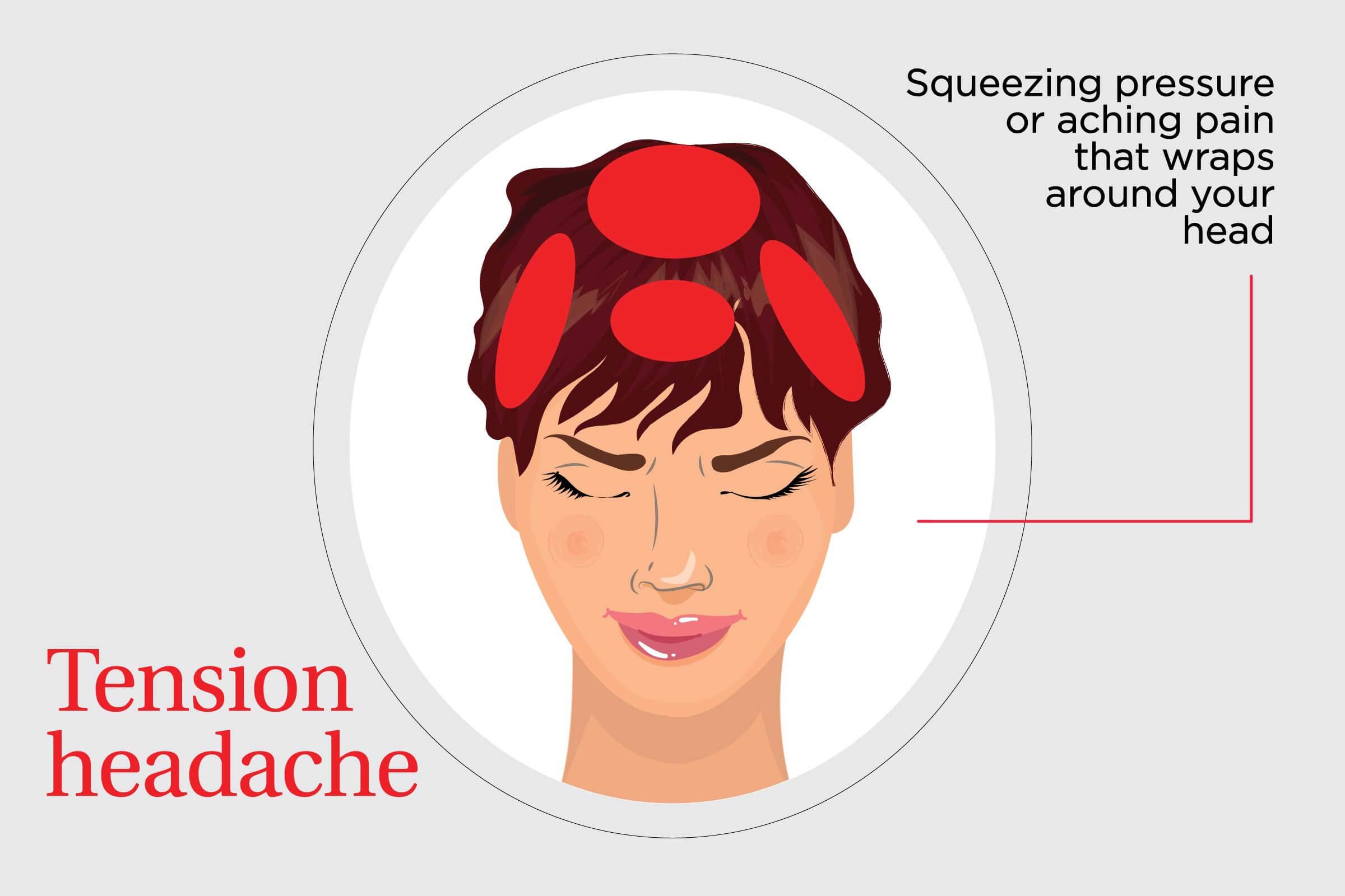 8 Types Of Headaches And How To Get Rid Of Them The Healthy