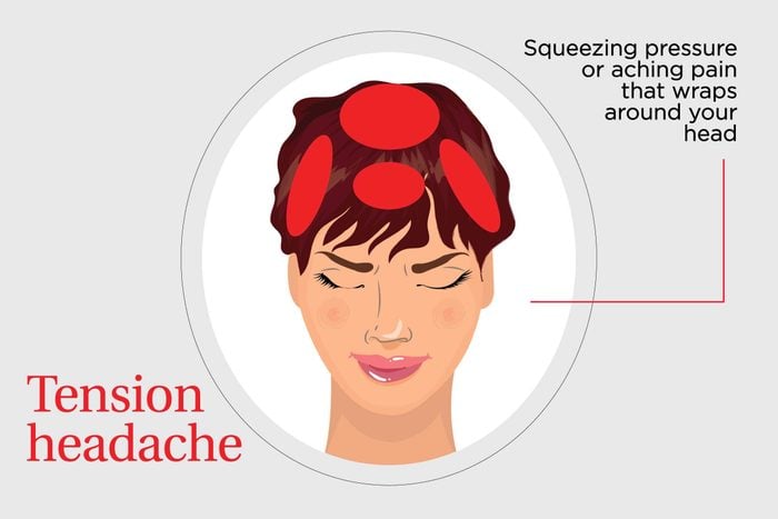 illustration of squeezing or pressure headache pain