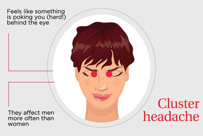 illustration of cluster headache pain