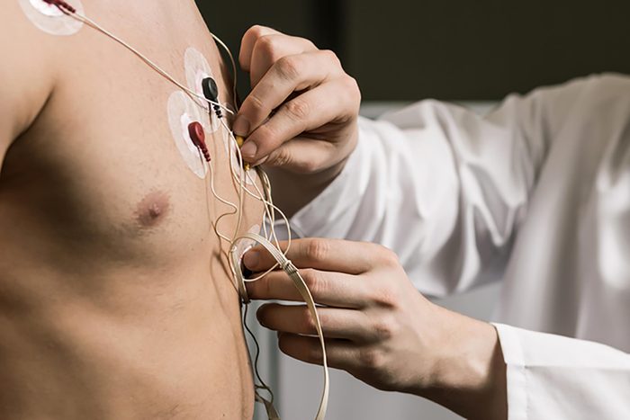 wires on chest for heart test