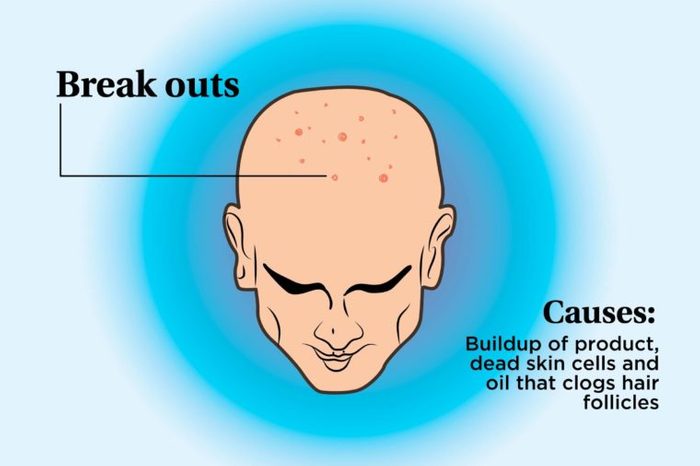 Doctors Discuss Alopecia and Other Conditions That Need Awareness