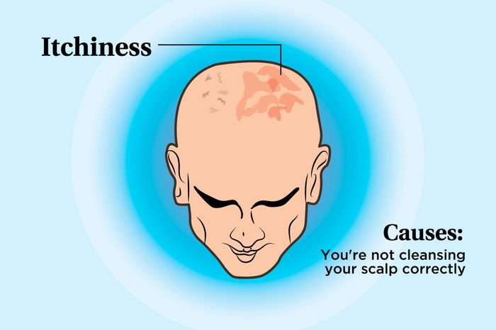 illustration of a person's scalp indicating itchiness