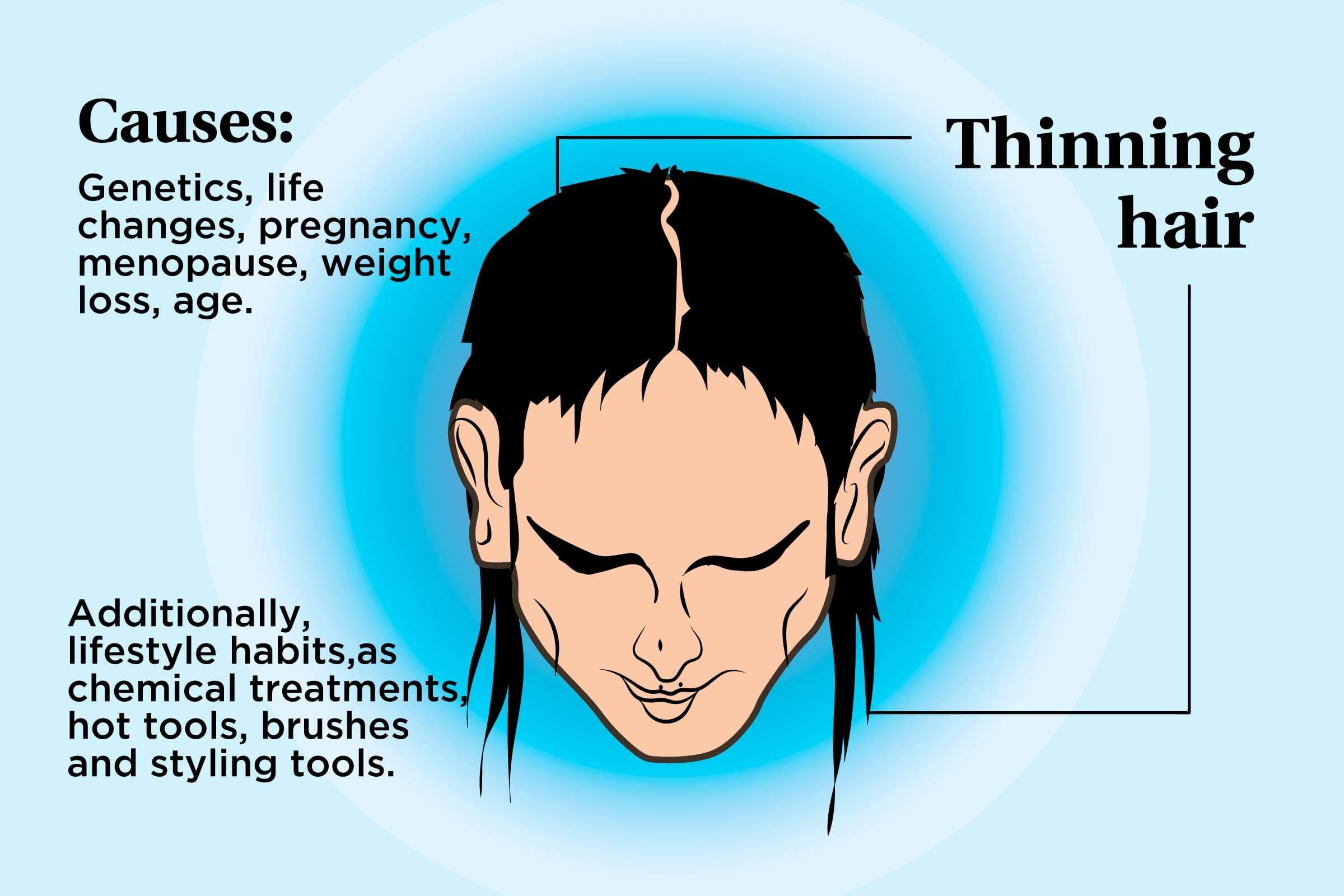 illustration of a person's scalp indicating thinning