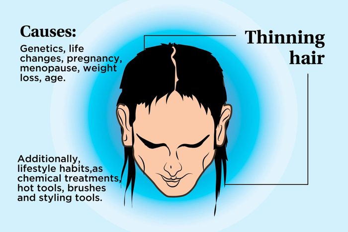 illustration of a person's scalp indicating thinning