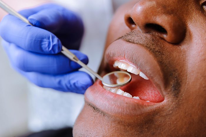 Dentist examining a man's teeth