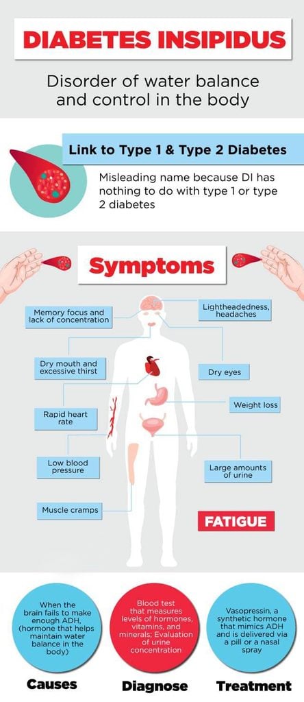 diabetes insipidus chart