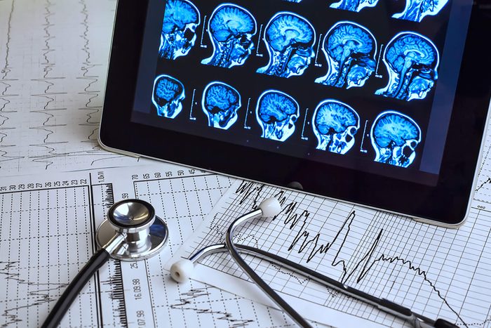 brain scans and images with stethoscope