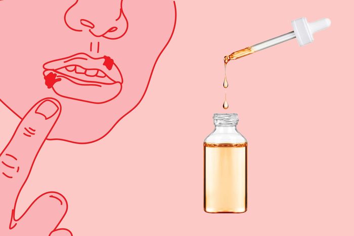 illustration of a mouth with cold sores with photo of dropper and bottle