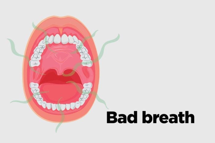 Illustration of an open mouth with bad breath.