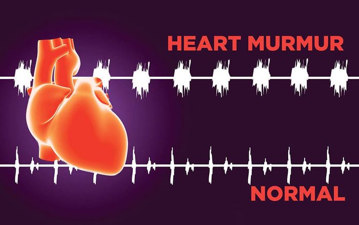 illustration of heart and cardiac rhythms--normal